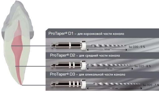 ProTaper Retreatment D1 (6 шт.)- для распломбировки каналов